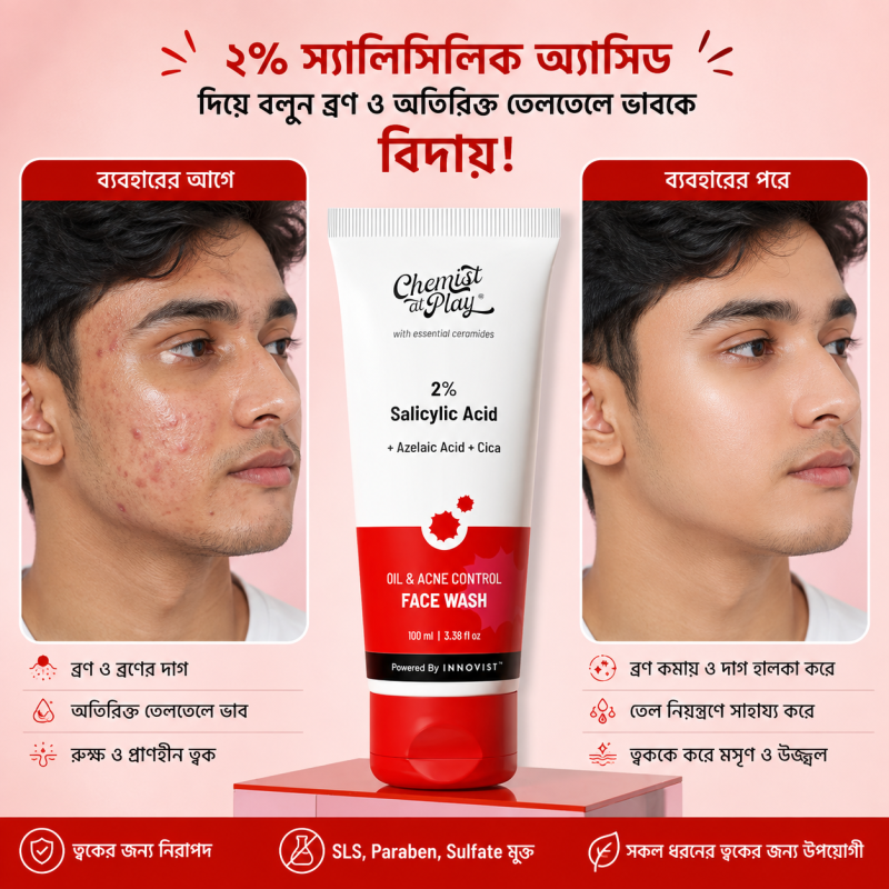 Chemist at Play 2% Salicylic Acid Oil & Acne Control Face Wash before and after results in Bangla, showing reduced acne, oil control, and clearer skin with Azelaic Acid and Cica.